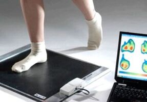 Diagnostic de l'hallux valgus