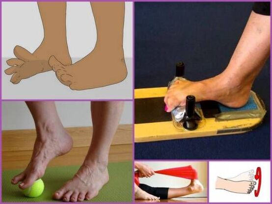 Physiothérapie pour la déformation du pied planovalgus