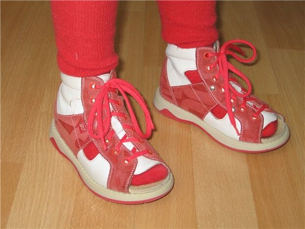 chaussures pour enfants souffrant d'hallux valgus