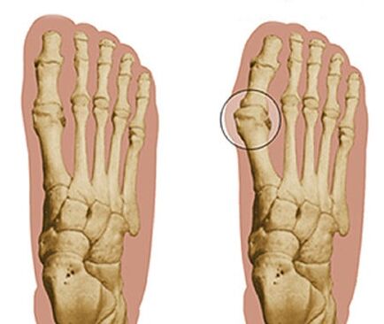 Développement du pied