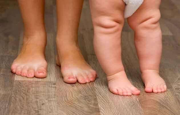 Déformation du pied chez les enfants